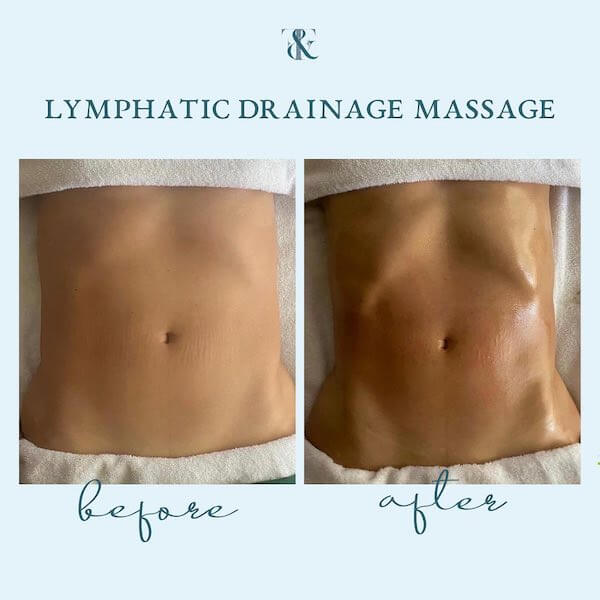 Signature Lymphatic Duo Lymphatic Drainage Massage Treatment Chicago