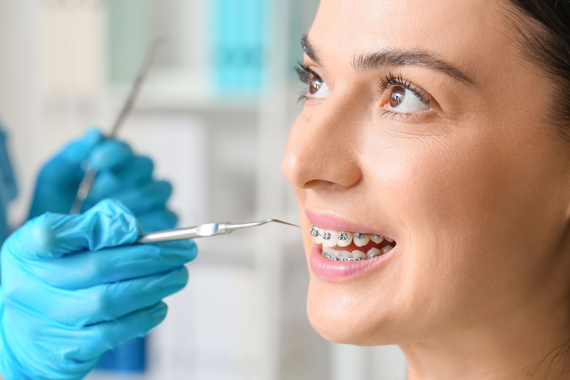 Un dentista con i guanti blu usa uno strumento metallico per esaminare i denti di una persona che porta l'apparecchio ortodontico.