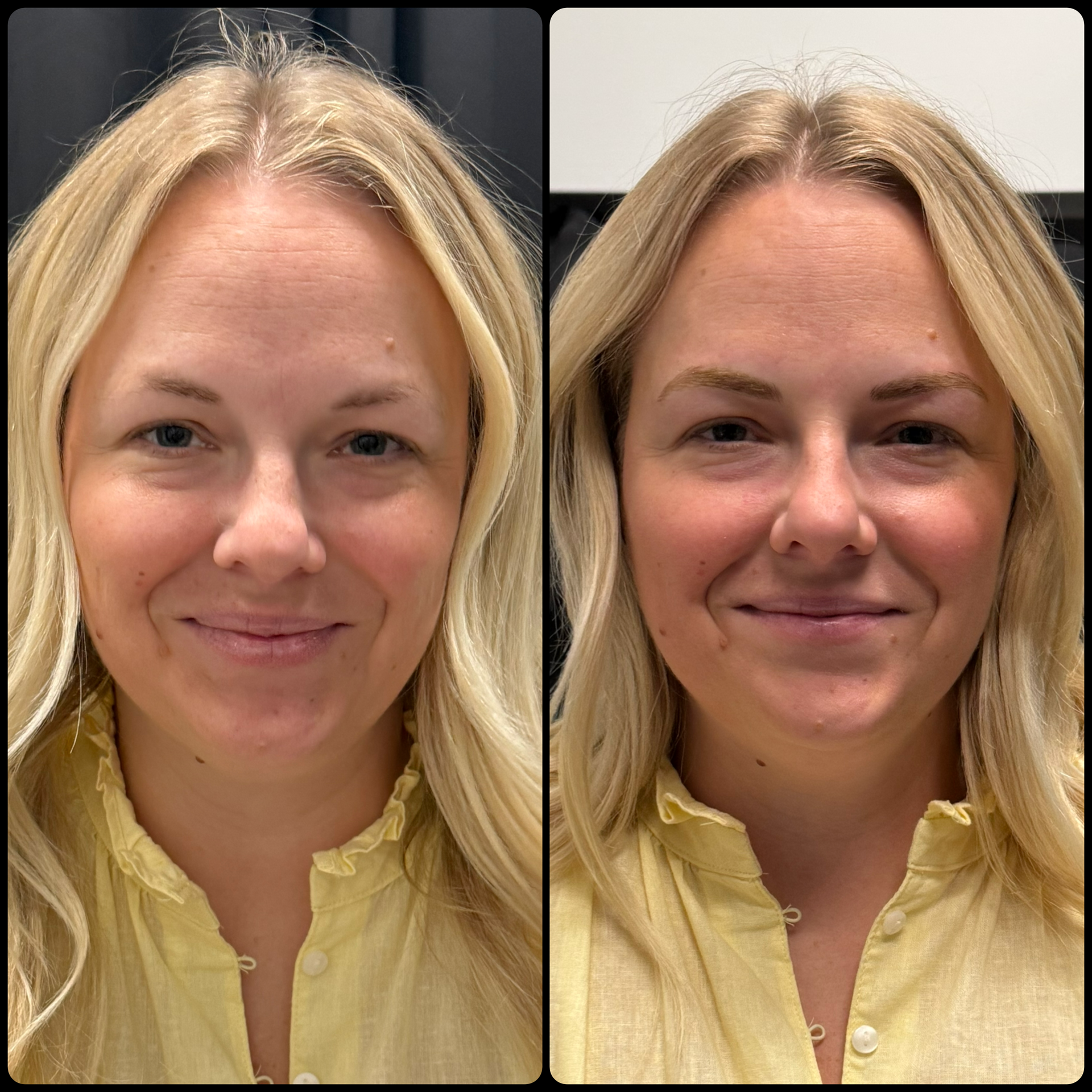 Side-by-side portrait of the same blonde person in a yellow shirt, neutral expression, before-and-after lighting or makeup