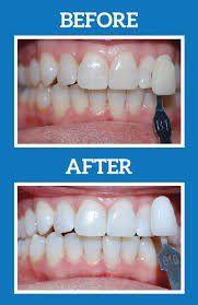 Dentist And Patient Discussing About Dental Treatment — Katy, Texas — Katy Dental Studio Dentist And Patient Discussing About Dental Treatment — Katy, Texas — Katy Dental Studio