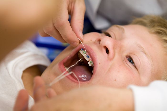 Little Boy Having His Teeth Examined By A Dentist — Katy, Texas — Katy Dental Studio Little Boy Having His Teeth Examined By A Dentist — Katy, Texas — Katy Dental Studio