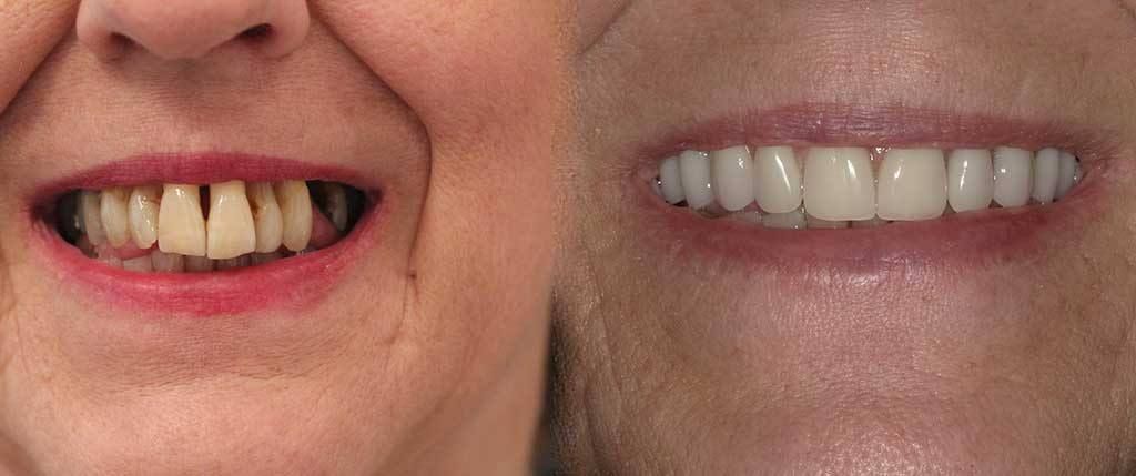 Our Results – Before & After