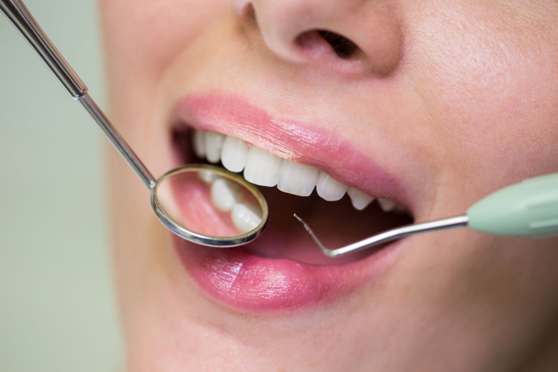 dental checkup