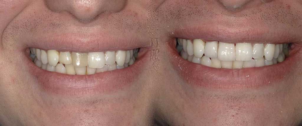 improper teeth