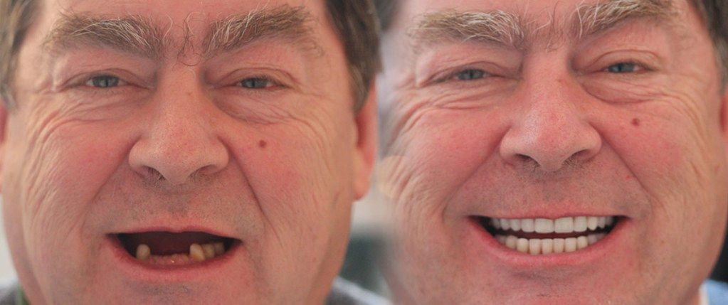 Our Results – Before & After