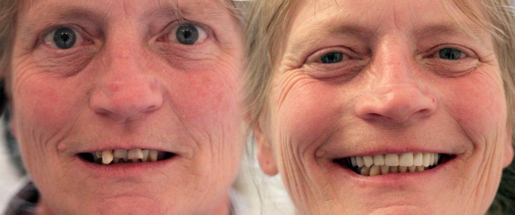 Our Results – Before & After