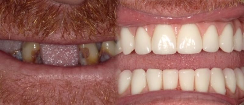 Our Results – Before & After