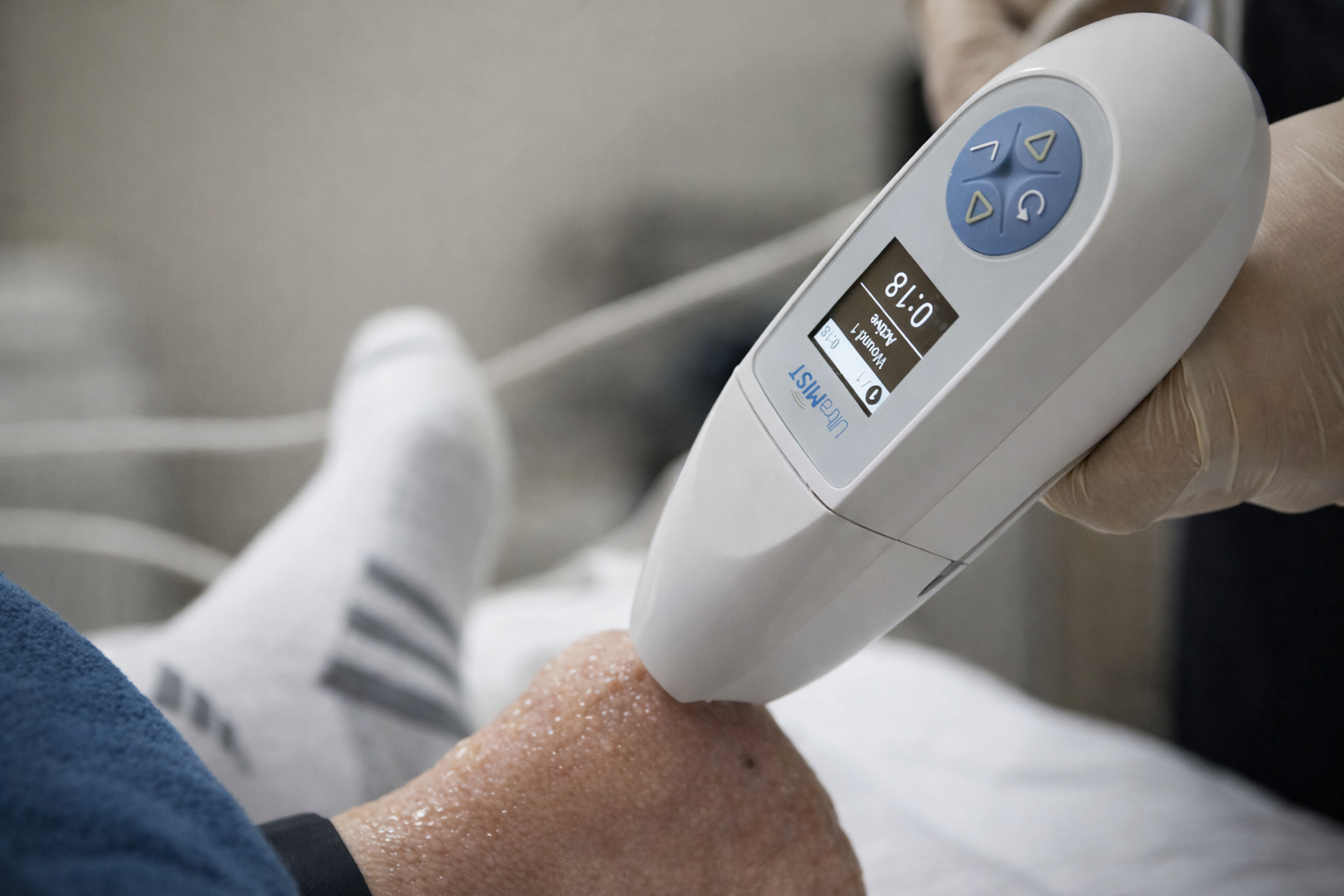 A medical professional uses a handheld laser therapy device on a patient's foot.