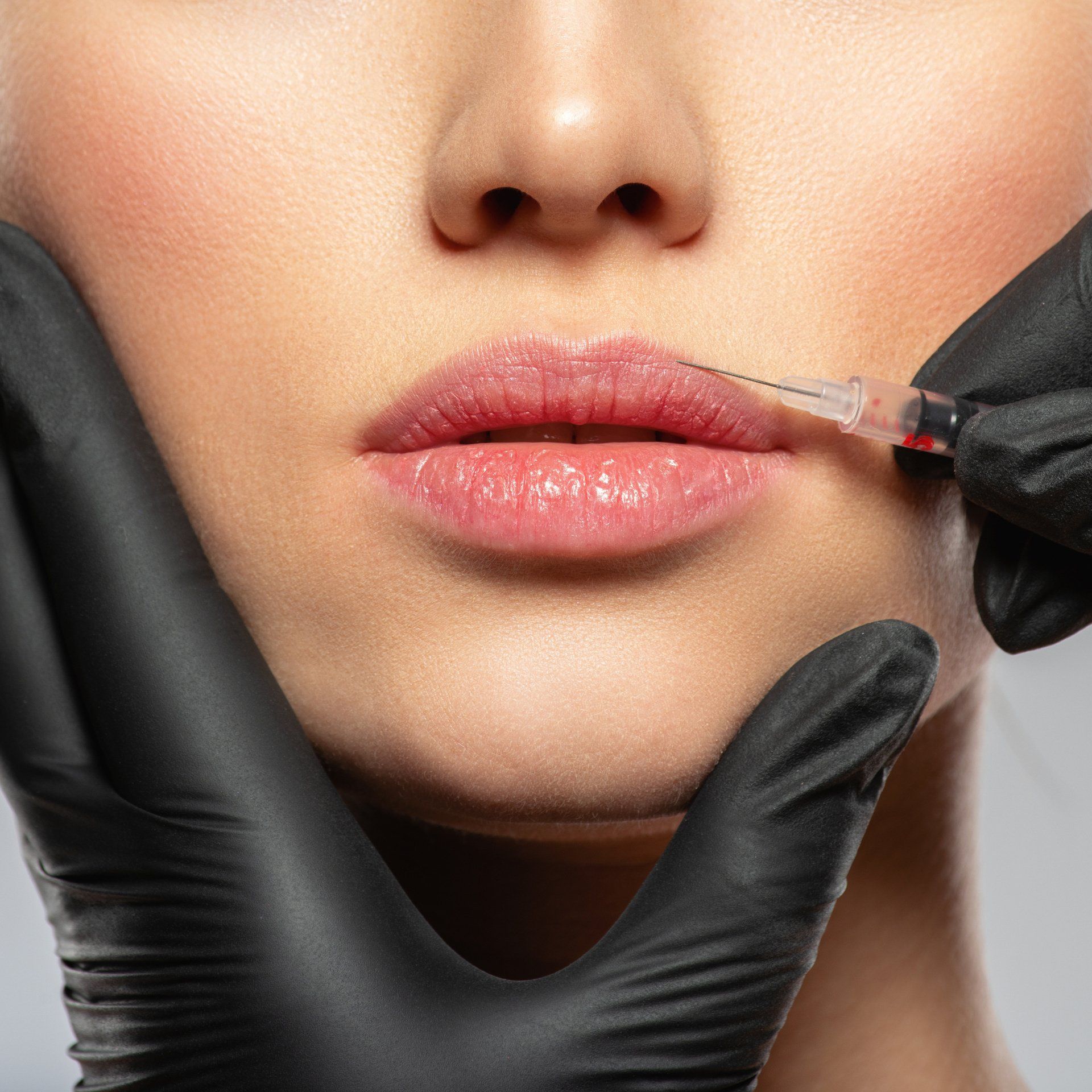 Lippen mit Spritze