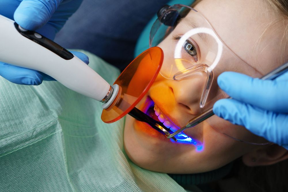 Dentist using a blue curing light on a patient’s teeth during treatment