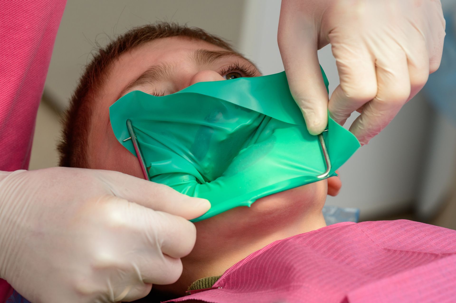 Dental tool applying clear gel to a white tooth near pink gums.