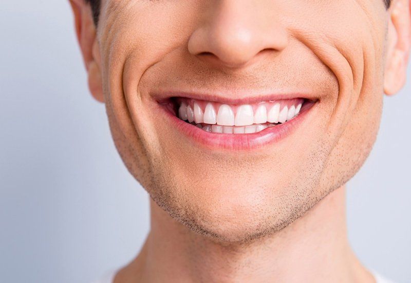 Teeth Whitening