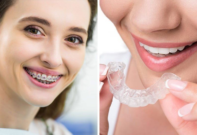 Orthodontics