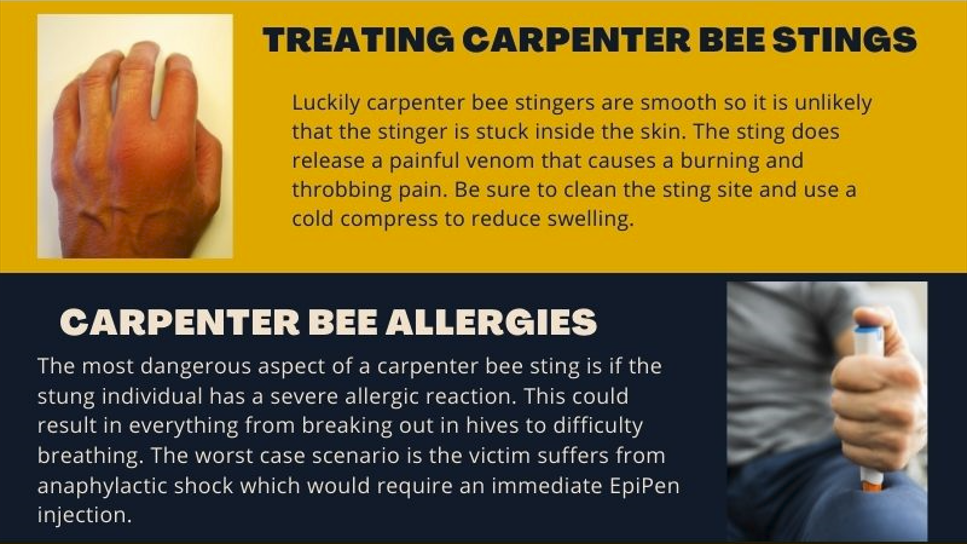 What you should do when you are stung by a carpenter bee, especially if you are allergic to bee stings. What you should do when you are stung by a carpenter bee, especially if you are allergic to bee stings.