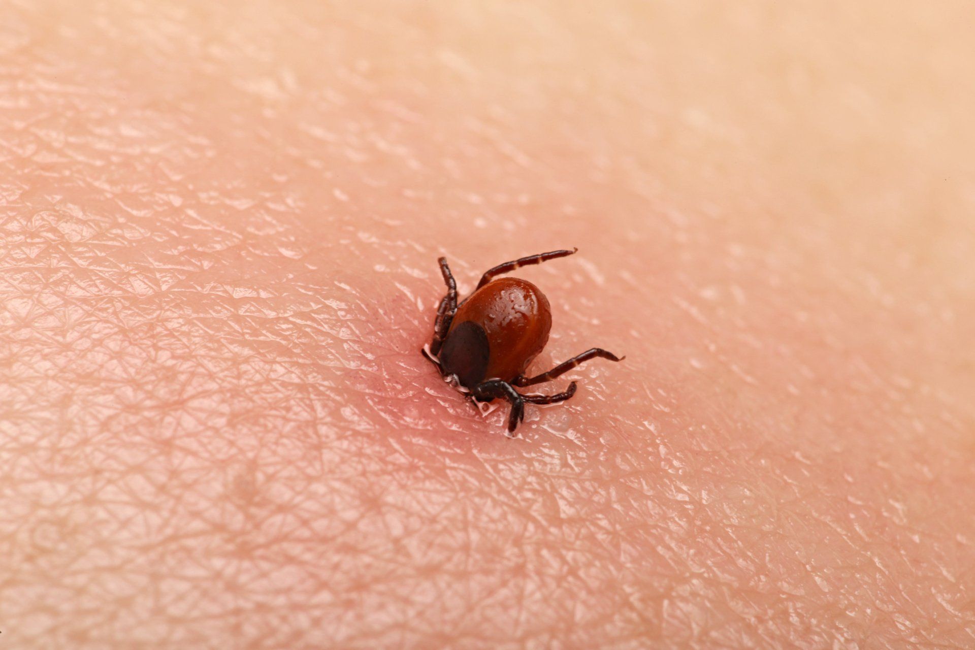 tick bite