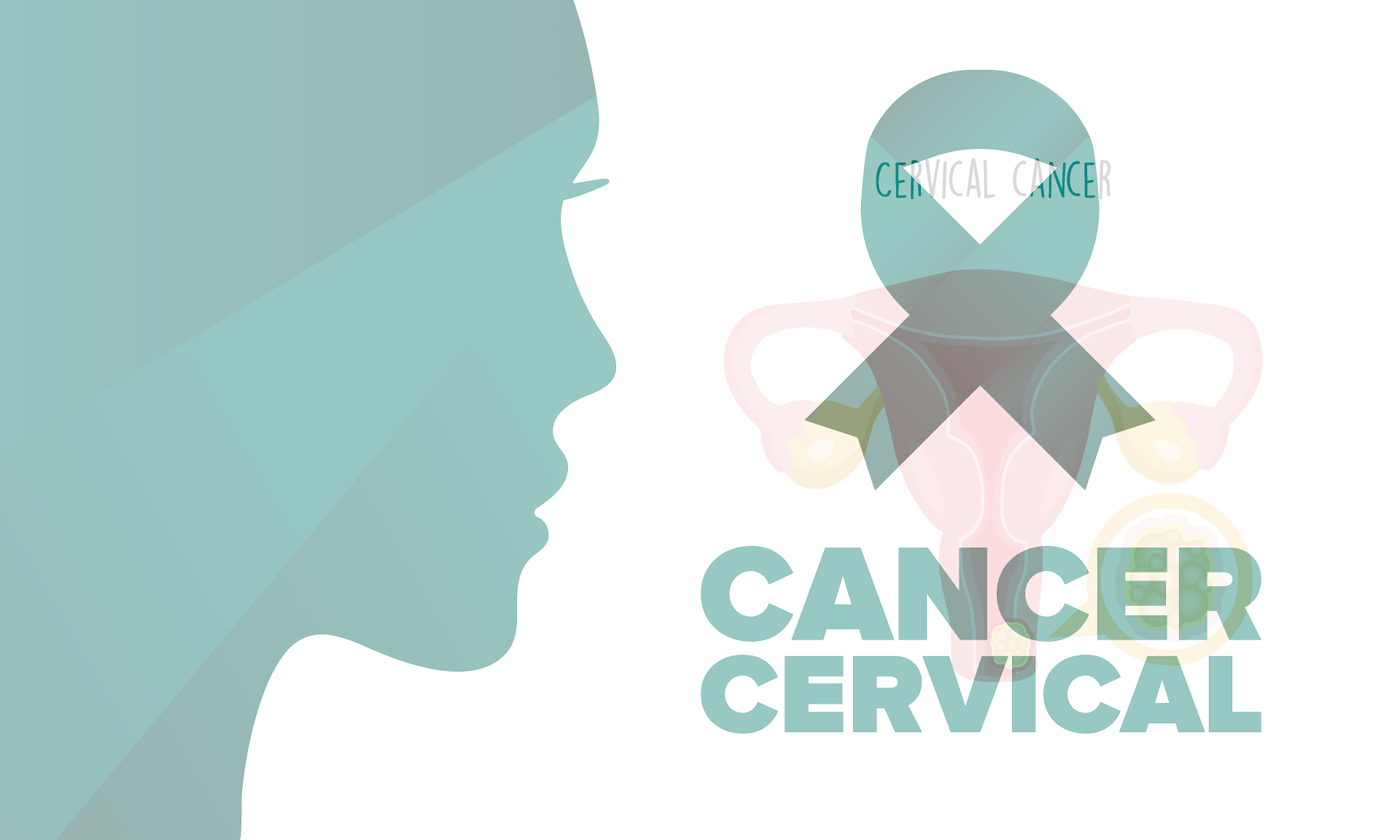 cancer vervical