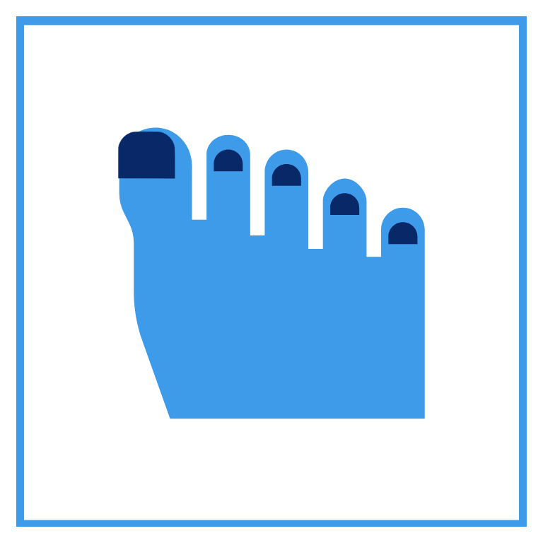 Ingrowing Toenails