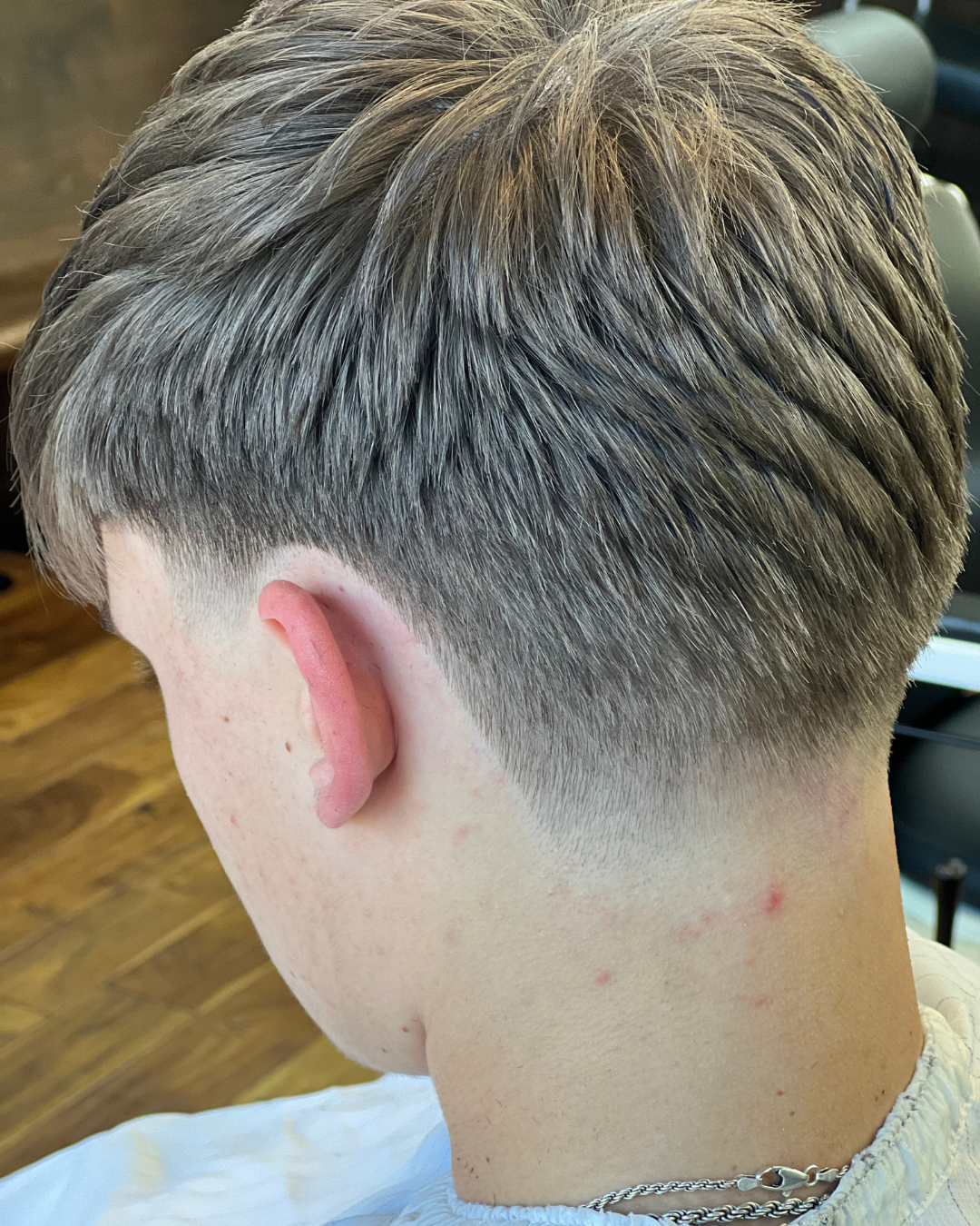 Close-up of a person's head and neck with a faded haircut, pale skin, and a red spot on the neck.