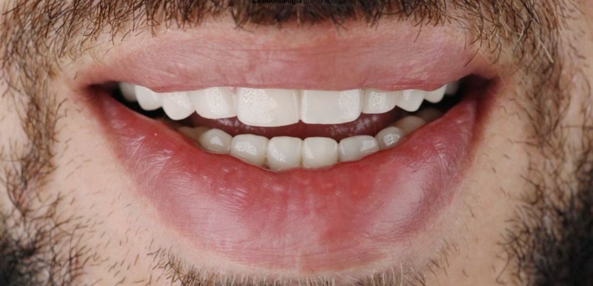 Un primer plano de la boca de un hombre con barba y dientes blancos.