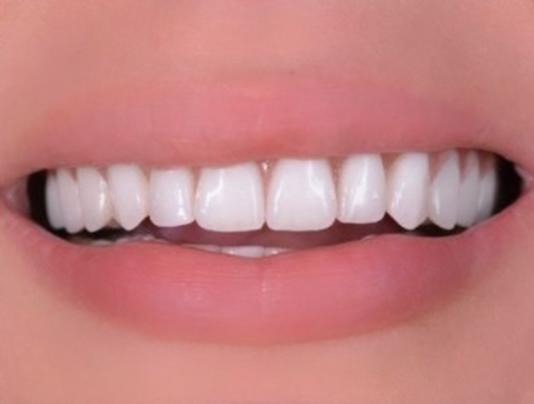 Un primer plano de la boca de una persona con dientes blancos.