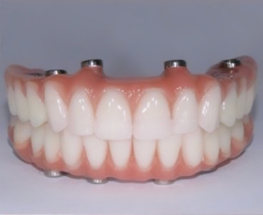 Un primer plano de una dentadura postiza sobre una superficie blanca.