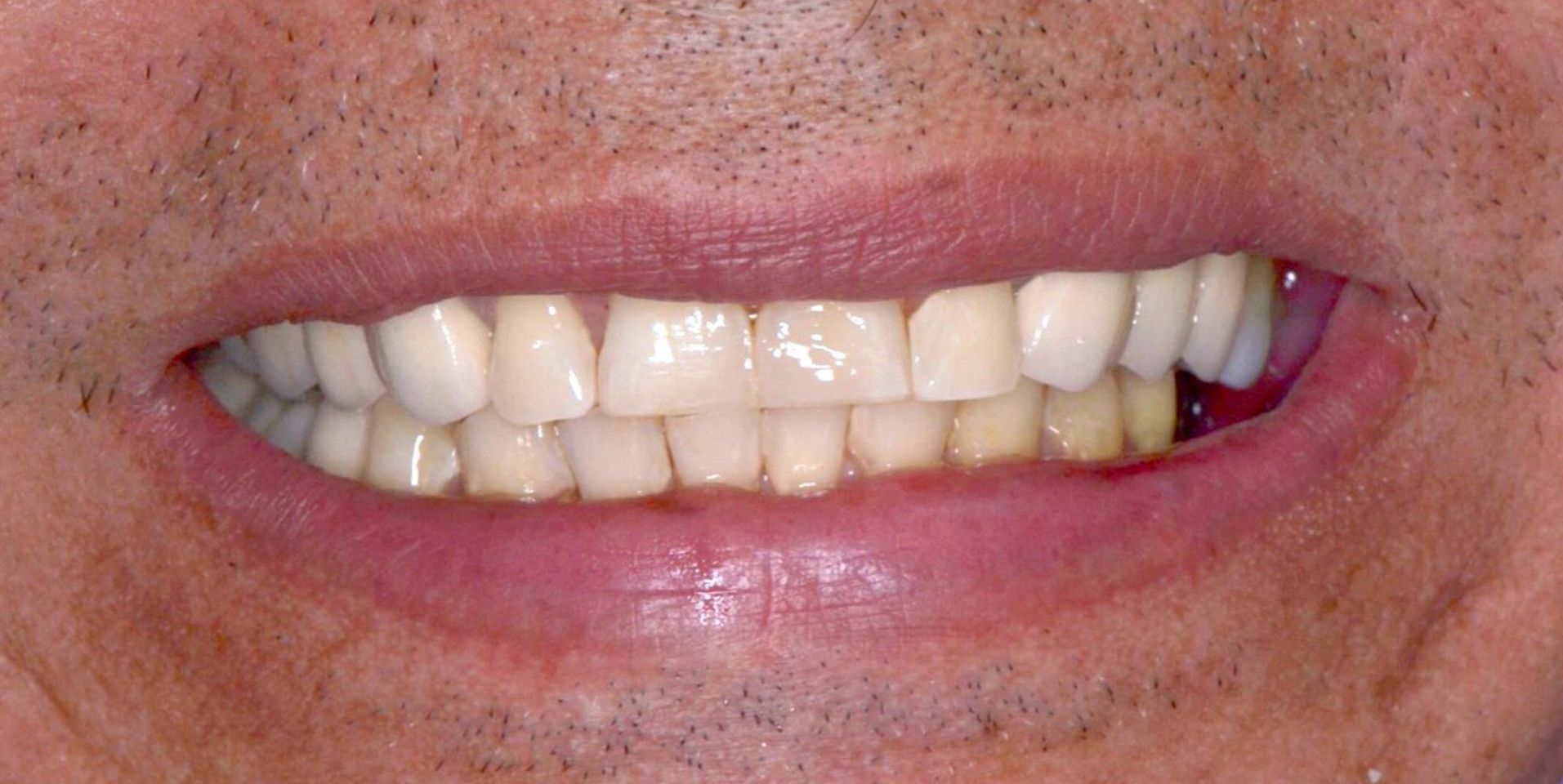 Un primer plano de la boca de un hombre con dientes blancos y una lengua roja.