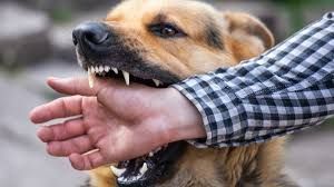 Dog biting a person's forearm, showing teeth. The person wears a plaid shirt.