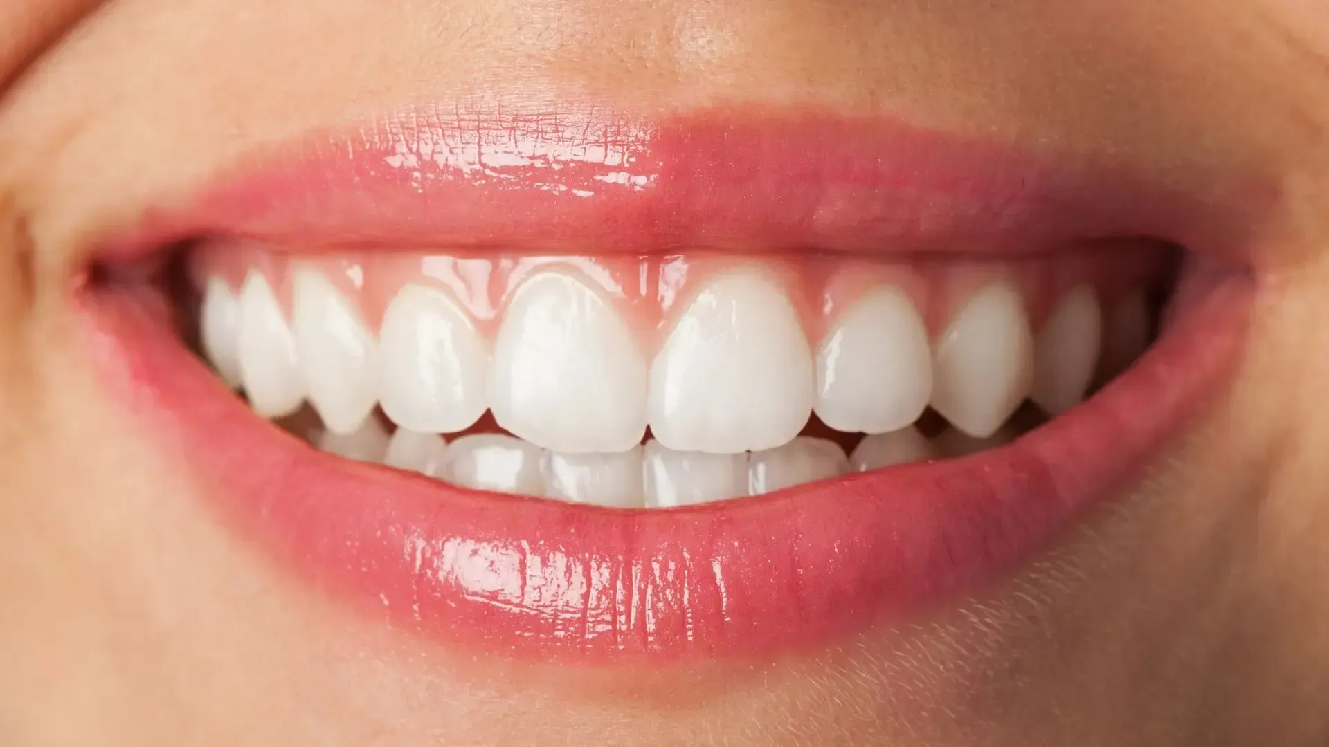 Close-up of a smiling mouth with bright white teeth and pink, glossy lips.