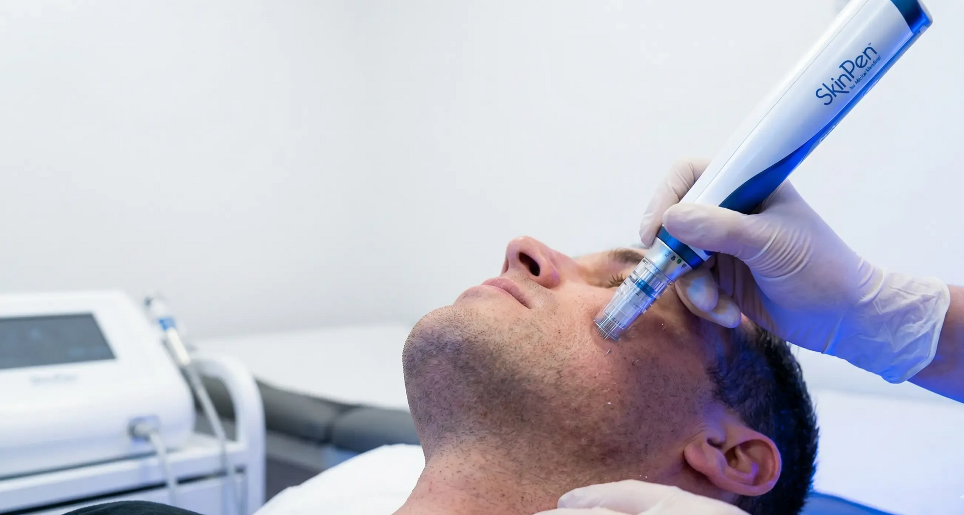 A professional performing microneedling on a client's cheek using a SkinPen device in a clinical setting.