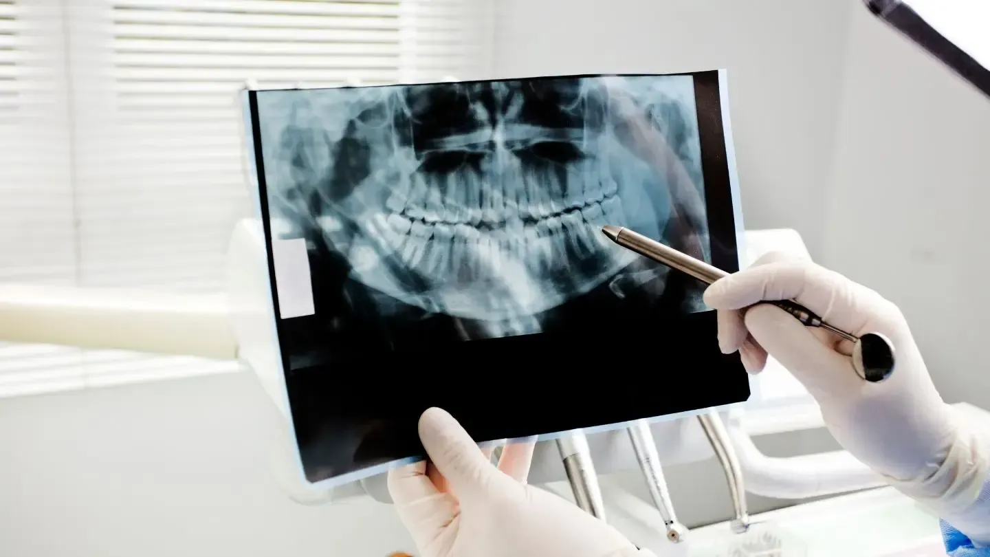 Dentist pointing to dental X-ray of teeth in clinic.