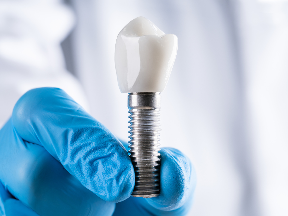 Dental implants candidacy assessment at Westmount Dental Waterloo
