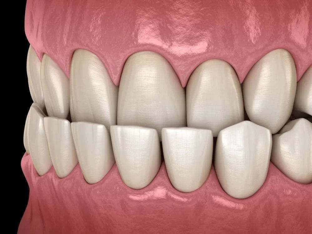 Close-up of a person smiling, showing straight, white teeth and lips.