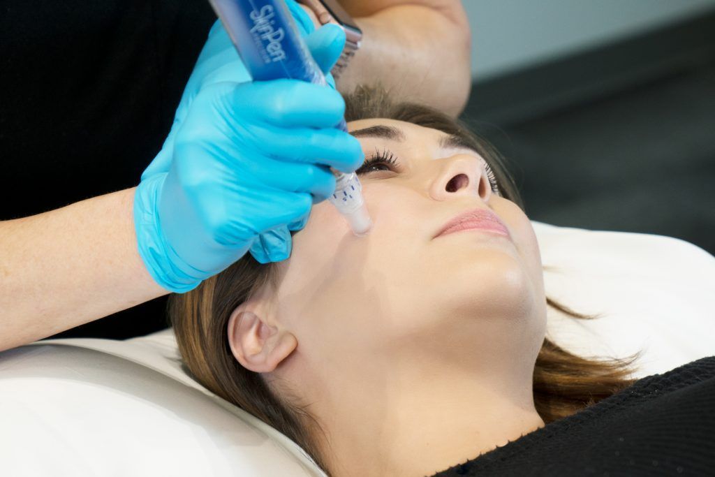 A practitioner in blue gloves uses a SkinPen device to perform a microneedling treatment on a client's cheek.