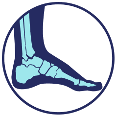 Foot silhouette with highlighted skeletal structure in a blue circle.