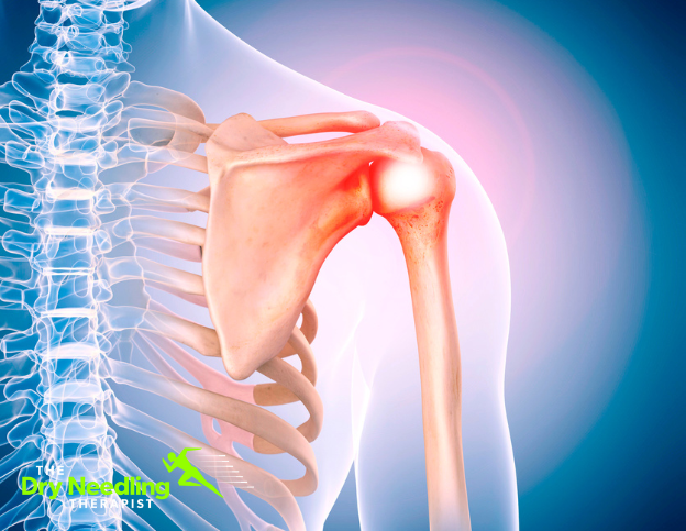Shoulder Pain