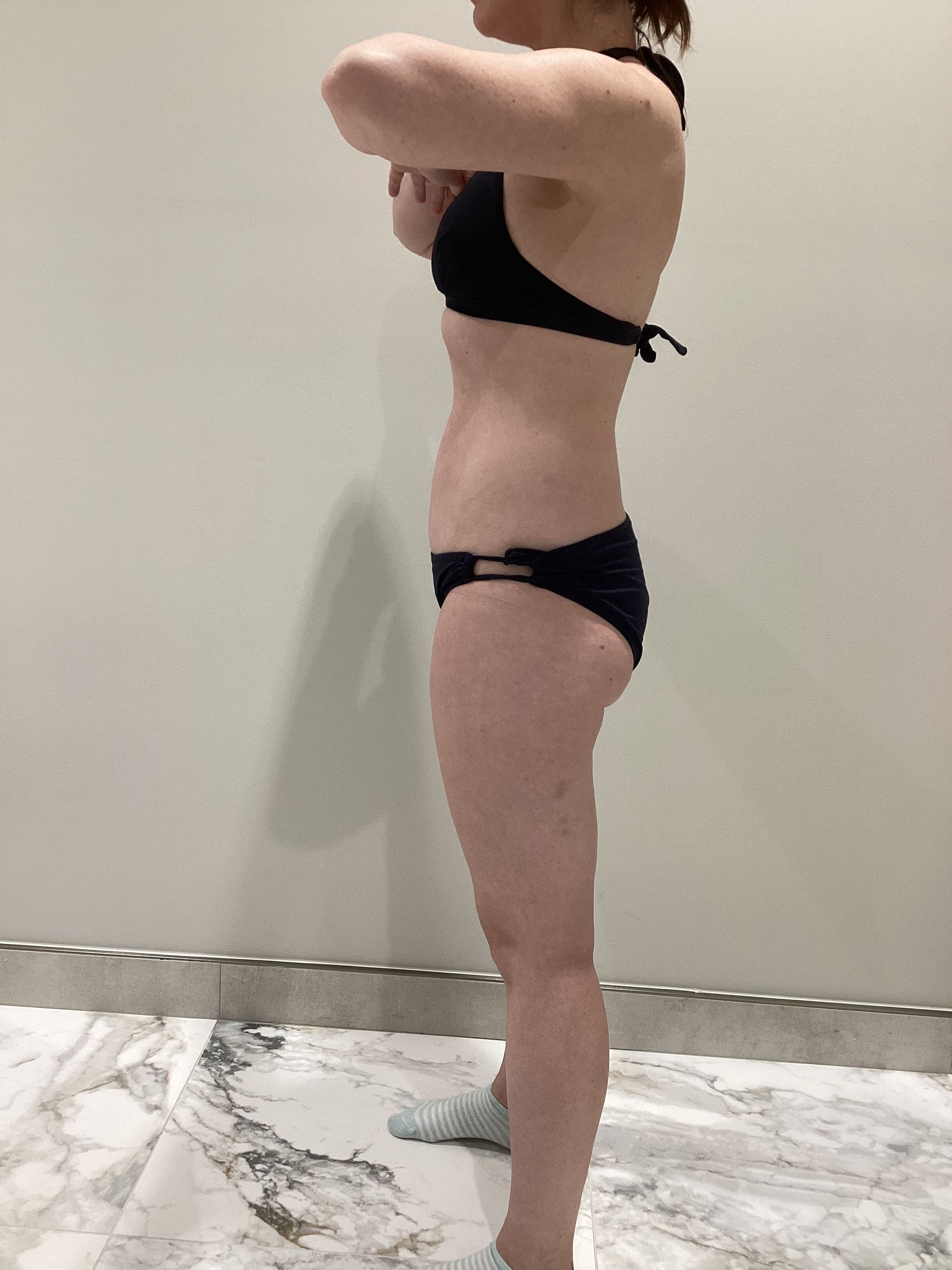 Side view of a woman showcasing the results of a non-surgical fat reduction treatment at The Body Lab Med Spa in Laredo.