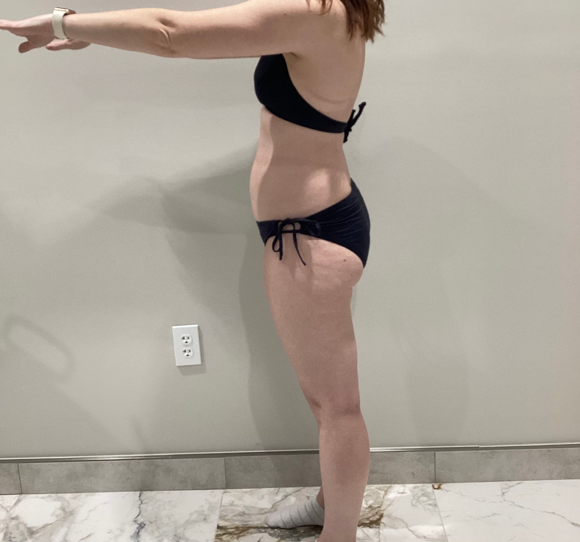  woman shows  off her physique from the side view before going through a non-surgical fat reduction treatment.