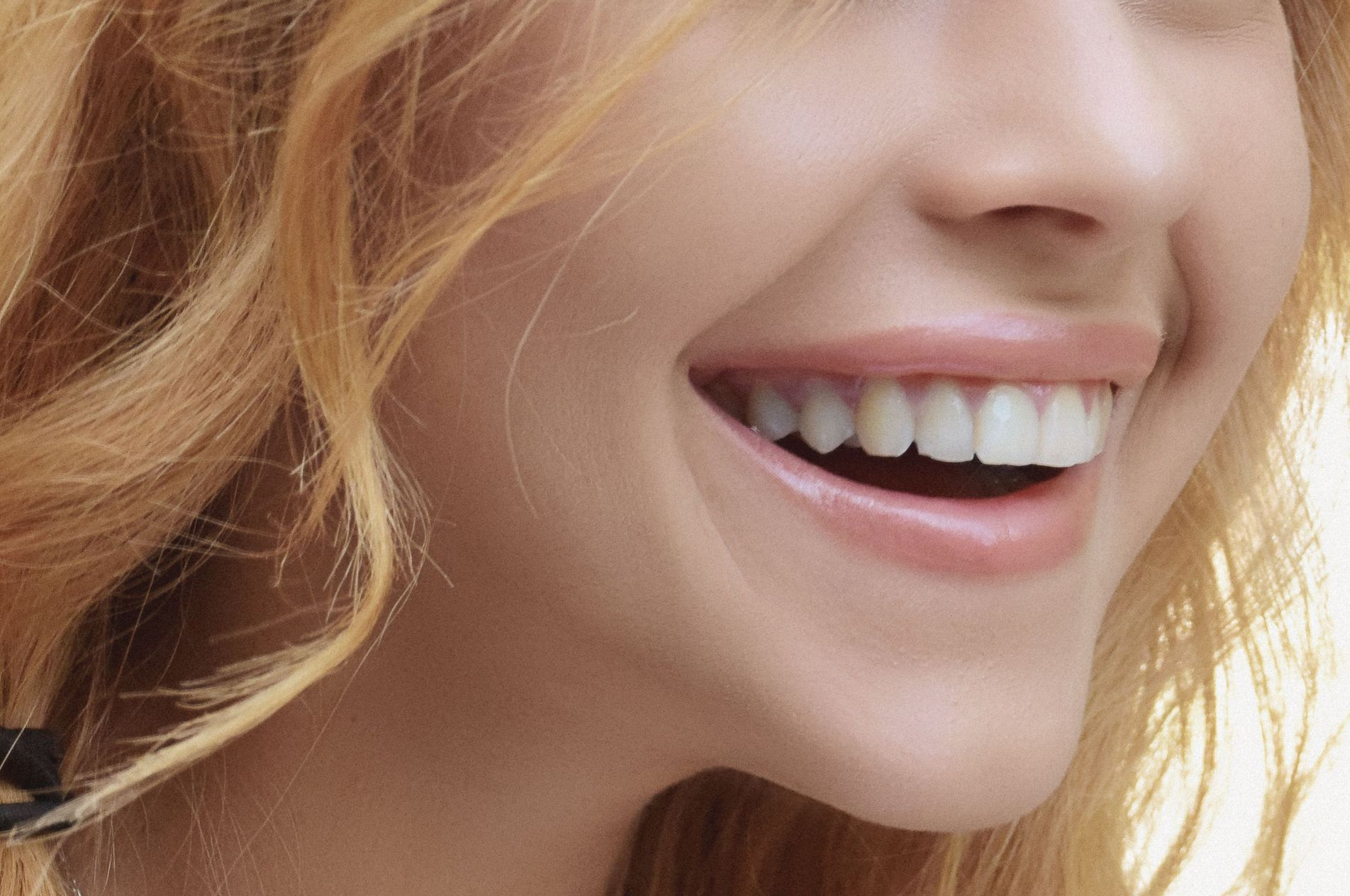 Ragazza con un sorriso Naturale dopo l'applicazione delle faccette