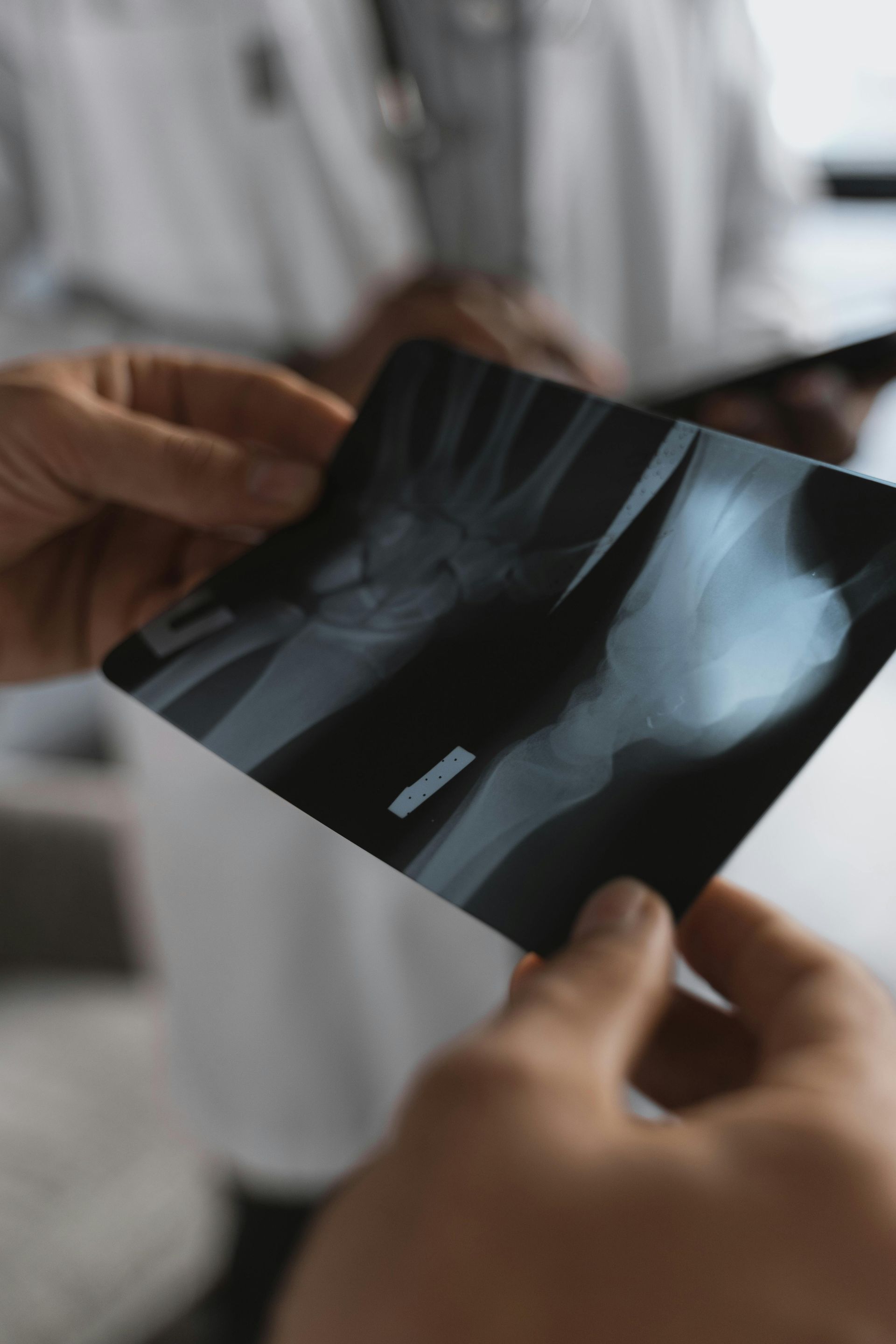 A doctor is holding an x-ray of a patient 's hand.