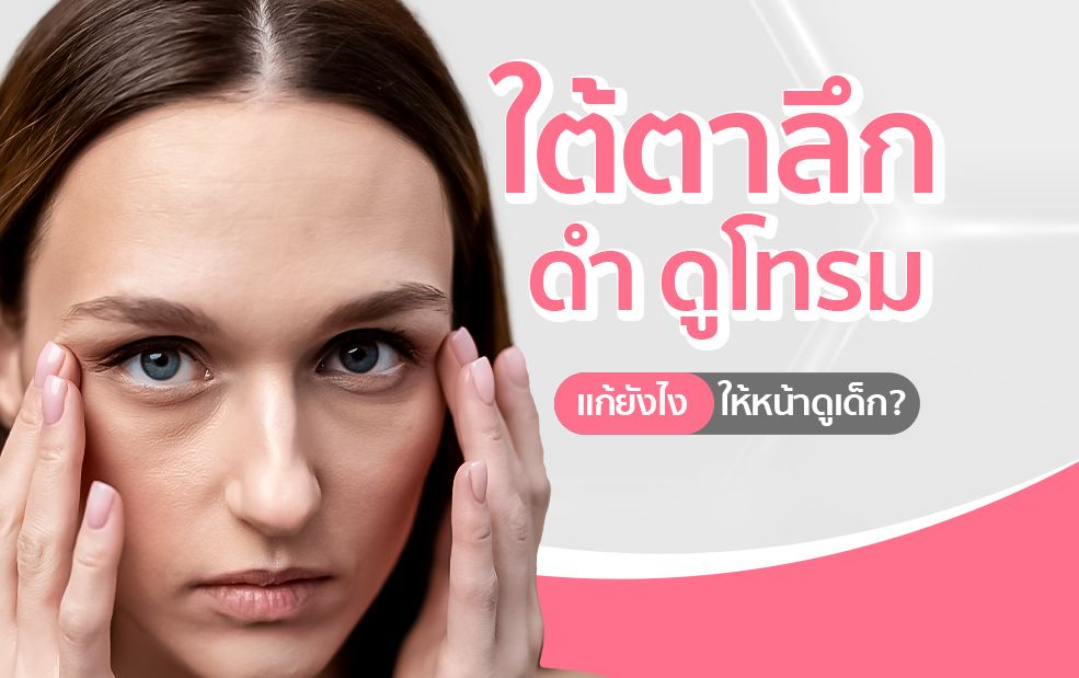 Woman holding under eyes, text about dark circles and looking younger.