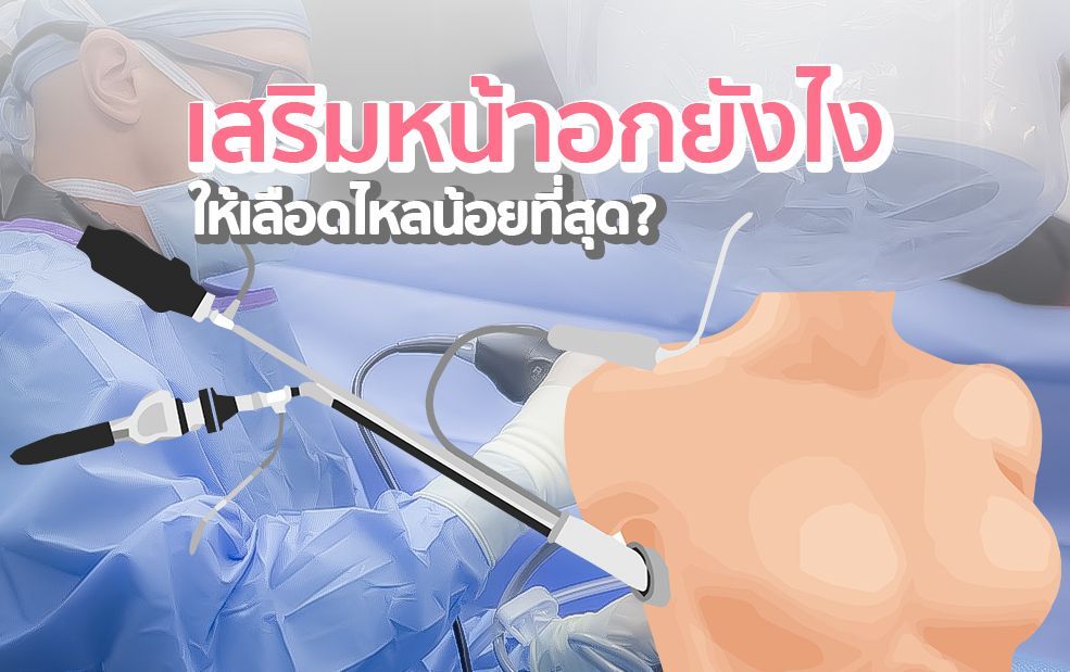 A surgical illustration shows a doctor using instruments to insert a breast implant. Text in Thai asks how to minimize bleeding.
