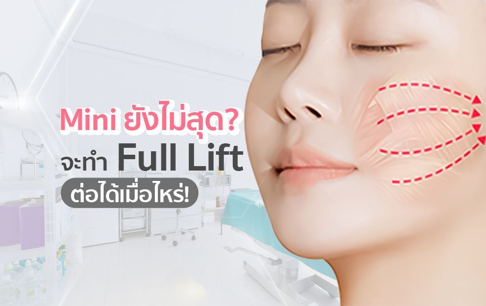 Woman's face with dotted lines showing facial lift. Text: Mini lift not enough? When to get a full lift.