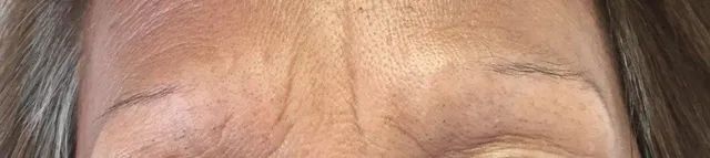 before brow tattoo