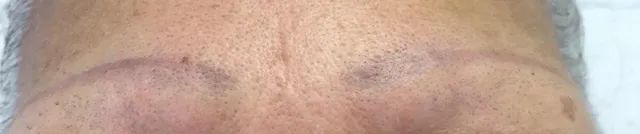 before brow tattoo