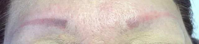 before brow tattoo