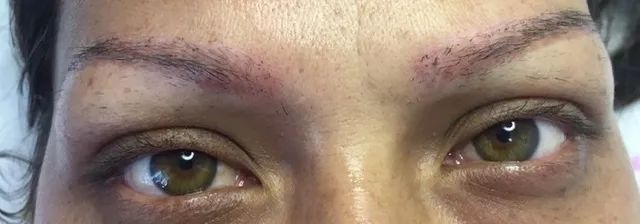 before brow tattoo