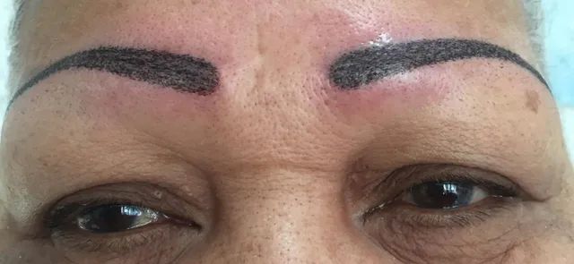 after brow tattoo