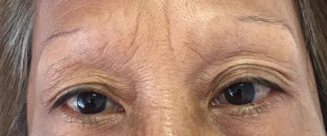 before brow tattoo
