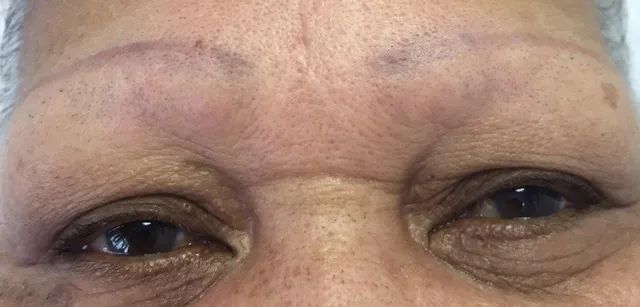 before brow tattoo