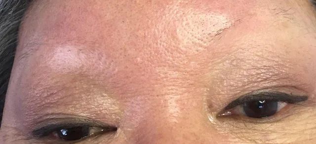 before brow tattoo